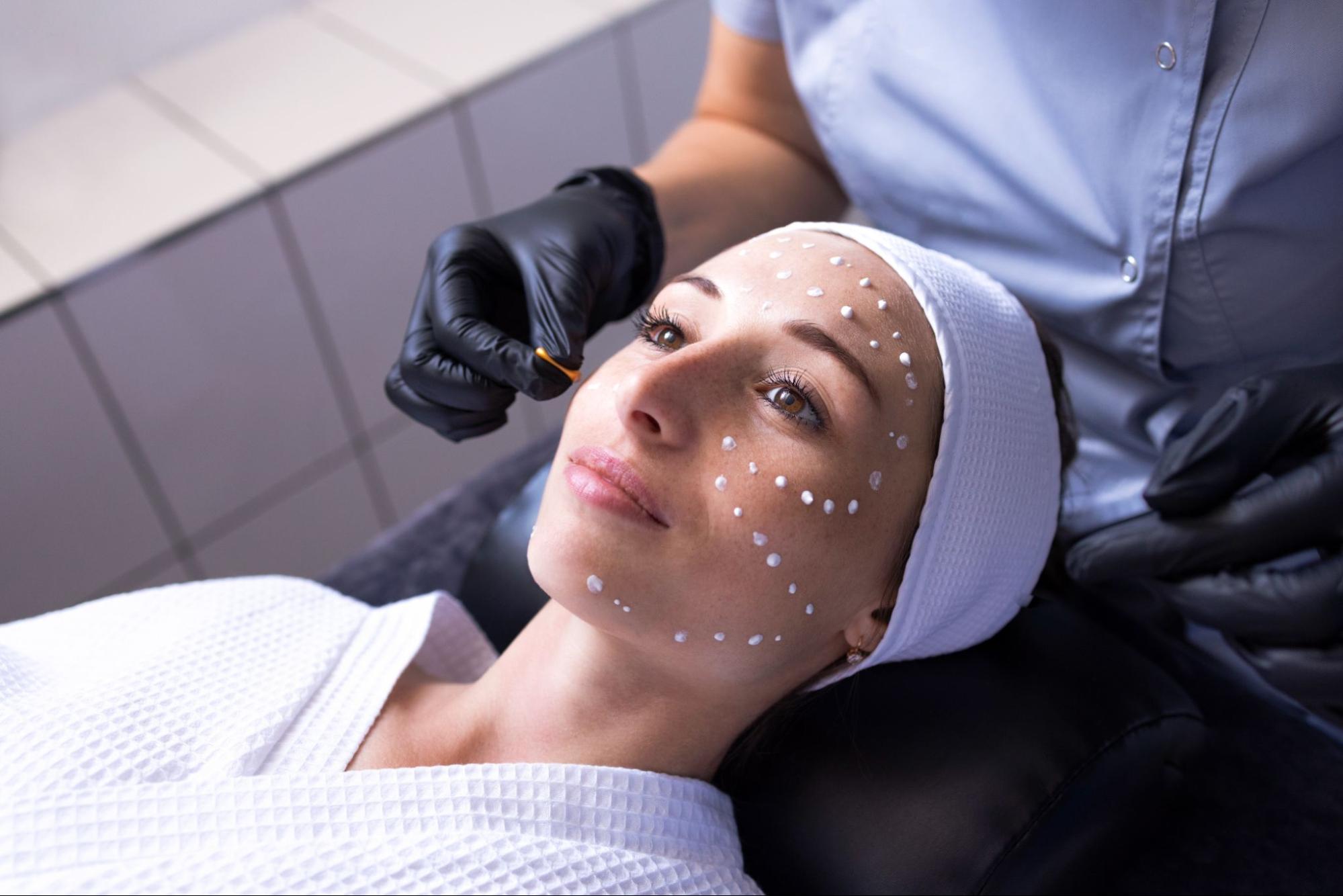 How Melasma Is Treated